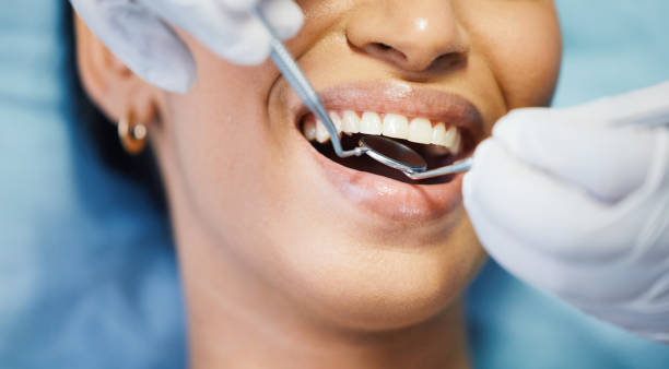 Best Pediatric Emergency Dentist in Sebastopol, CA